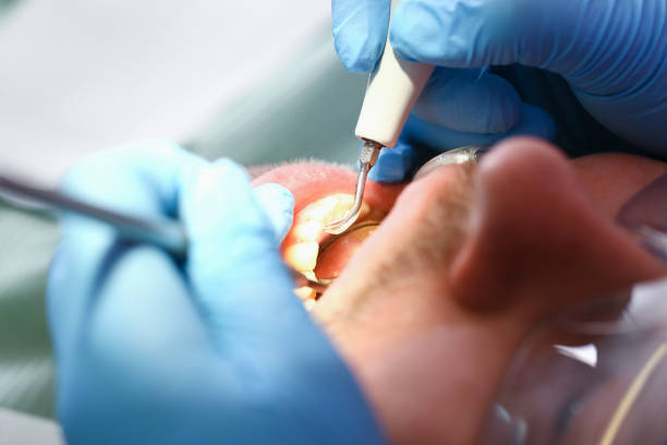 Best Emergency Tooth Extraction in Lakehurst, NJ
