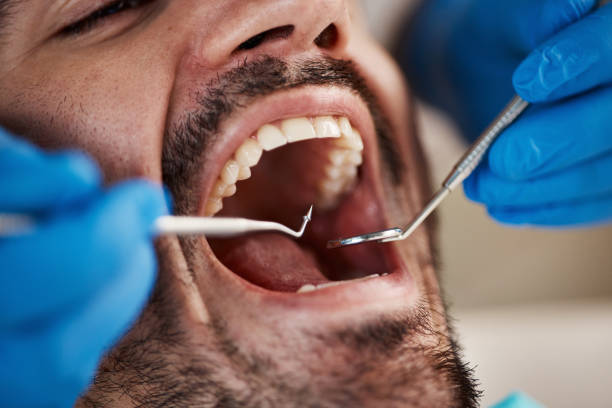 Best Emergency Dental Care for Broken or Chipped Teeth in Lakehurst, NJ